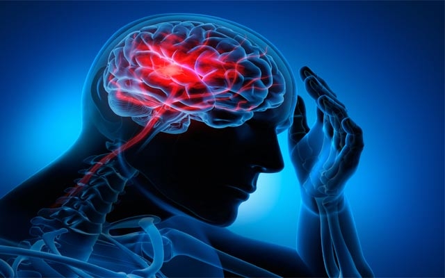 چۆن خۆت لە جەڵتەی مێشك دپارێزیت؟