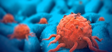 فاكهة تقلل نمو الخلايا السرطانية بنسبة 60%