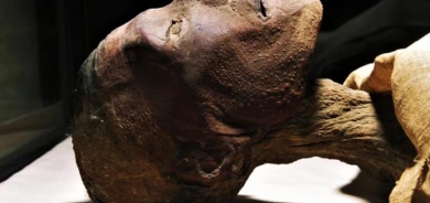 علماء يرجحون إصابة الفراعنة بـ«جدري القردة»