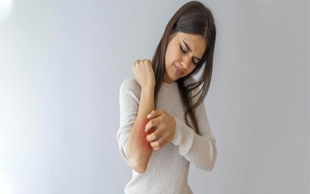 خورشتی پێست پاش زیاد ئارەقەكردن