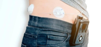 دراسة: «البنكرياس الإلكتروني» أفضل لمرضى السكري