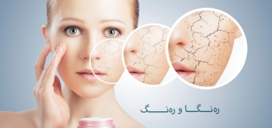 وشكیی پێست واتە نەمانی  نەرمونیانیی روخسارت