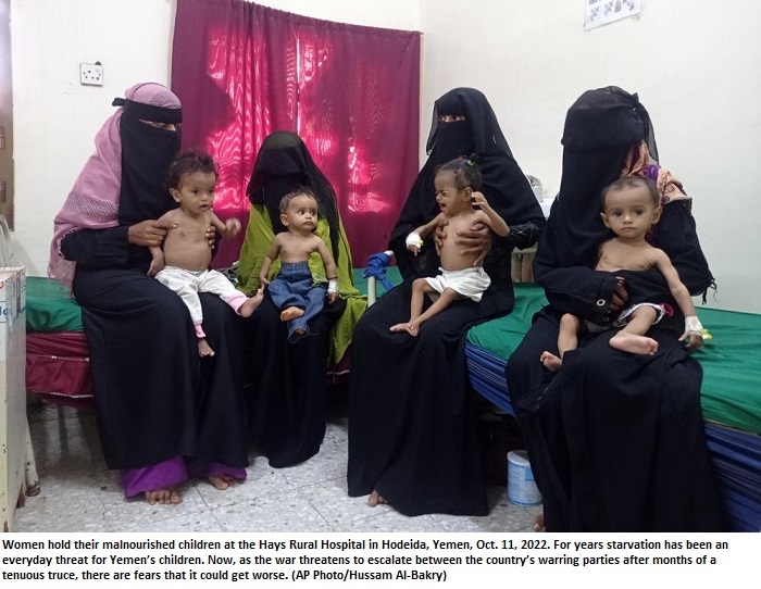 Children starve as Yemen teeters on a return to fighting