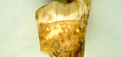 هل كان الإنسان البدائي من آكلي اللحوم؟