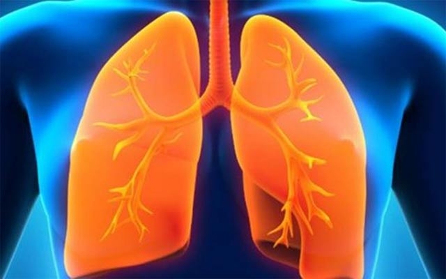 چۆن تەندروستیی سییەكانت باشتر دەكەیت؟