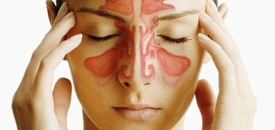 طبيب روسي يكشف طرق علاج التهاب الجيوب الأنفية