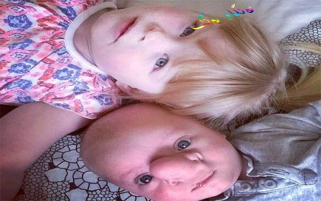 مێشك و لووتی بەیەكەوەیە