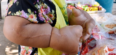 دەست و بازووی زەبەلاح