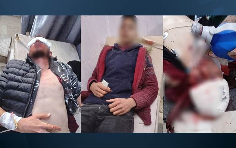 Tirkiyê Şehba topbaran kir: Kuştî û birîndar hene