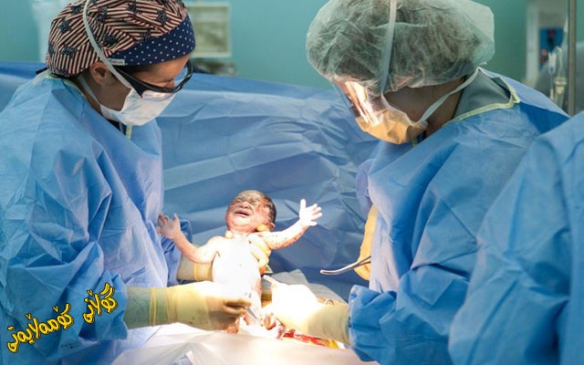 منداڵبوون بە ڕێگەی نەشتەرگەری لە هەڵكشاندایە