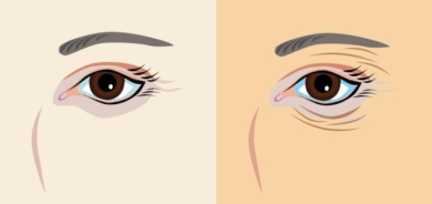 الشيخوخة المبكرة... أسبابها ووسائل درئها