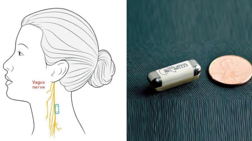 علاجات إلكترونية لالتهاب المفاصل