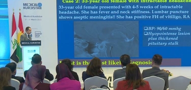 عقد مؤتمر كوردستان الطبي في أربيل بمشاركة 90 طبيباً