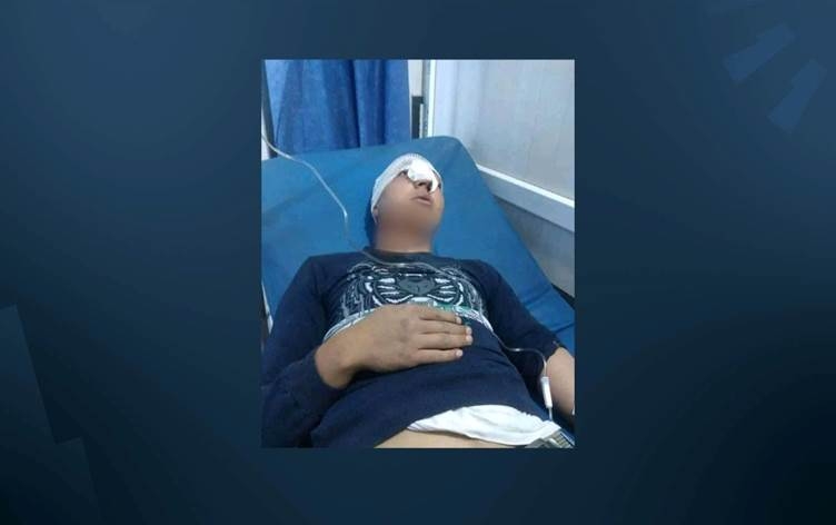 EFRÎN - Çekdaran ciwanekî Kurd ji ber ala Kurdistanê bi giranî birîndar kirin