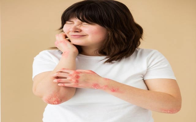 هەستەوەریی پێست لە وەرزی بەهار