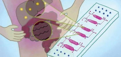 «شريحة» تحاكي الأمعاء والكبد لفهم الأمراض