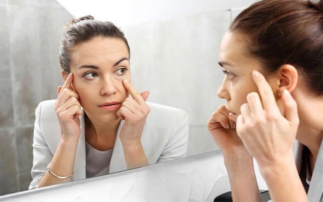 وشكبوونی پێستی ژێر چاوەكان