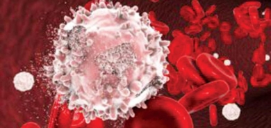 تركيبة تنهي مقاومة خلايا سرطان الدم