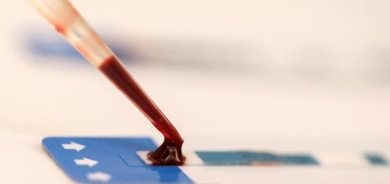 40 عاماً على اكتشاف فيروس الإيدز