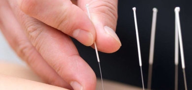 دراسة يابانية: الوخز بالإبر في الأذن يساعد بإنقاص الوزن