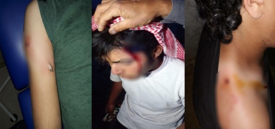 Ciwanekî Kurd li Efrînê hate kuştin