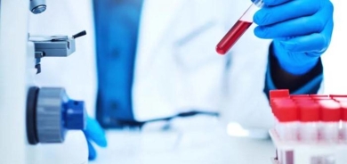 بروتينات في الدم تتنبأ بحدوث سرطان الرئة