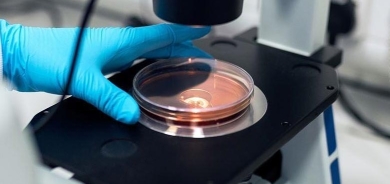 Li Akrê yekem haleta taya xwînberbûnê hat tomarkirin