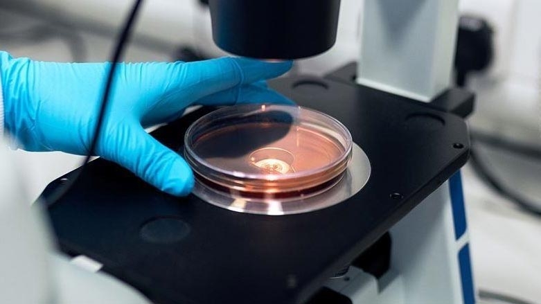 Li Akrê yekem haleta taya xwînberbûnê hat tomarkirin