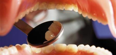 اكتشاف روابط جديدة بين صحة الأسنان والتدهور المعرفي