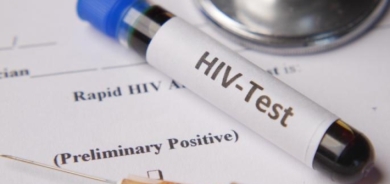 NY: Dibe ku AIDS heta 2030yê bi dawî bibe