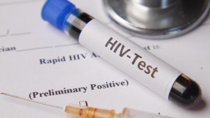 NY: Dibe ku AIDS heta 2030yê bi dawî bibe