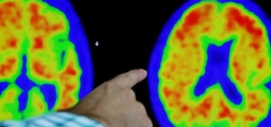 علماء يكشفون 5 أمور يمارسونها للحفاظ على صحتهم العقلية