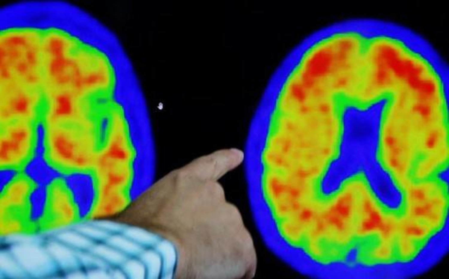 علماء يكشفون 5 أمور يمارسونها للحفاظ على صحتهم العقلية