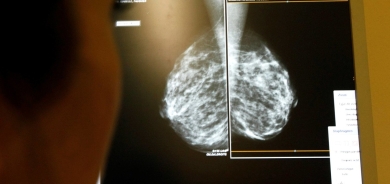 عقار تجريبي جديد يضعف سرطان الثدي العدواني