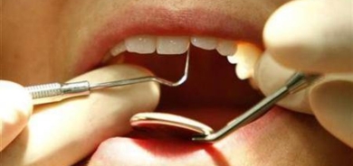 هل يمكنك إزالة جير أسنانك بنفسك؟ خبير يجيب