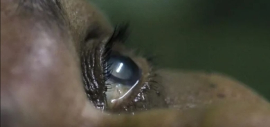 الصحة العالمية: العراق يتخلص من مرض خطير يسبب العمى