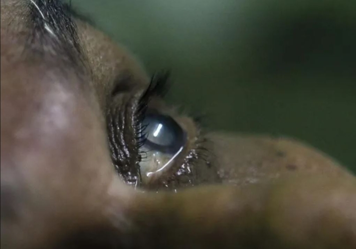 الصحة العالمية: العراق يتخلص من مرض خطير يسبب العمى