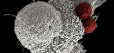 اكتشاف طريقة غير متوقعة لانتشار الخلايا السرطانية