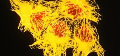 طبيب: الشعور بالحرقة قد يشير للإصابة بسرطان المريء