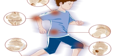 4 أعراض تشير لالتهاب مفاصل الأطفال يجب الانتباه إليها