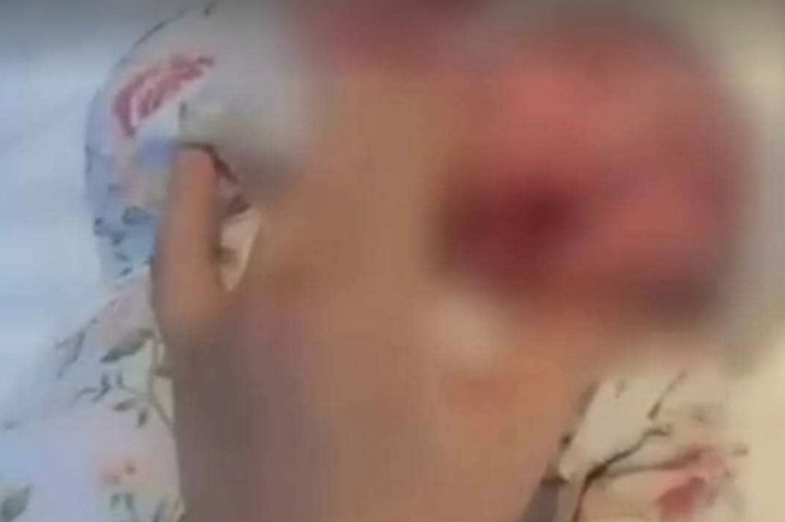 توضيح من وزارة الصحة بخصوص حادثة «تعنيف» طفلة حديثة الولادة بإحدى المشافي الخاصة في أربيل