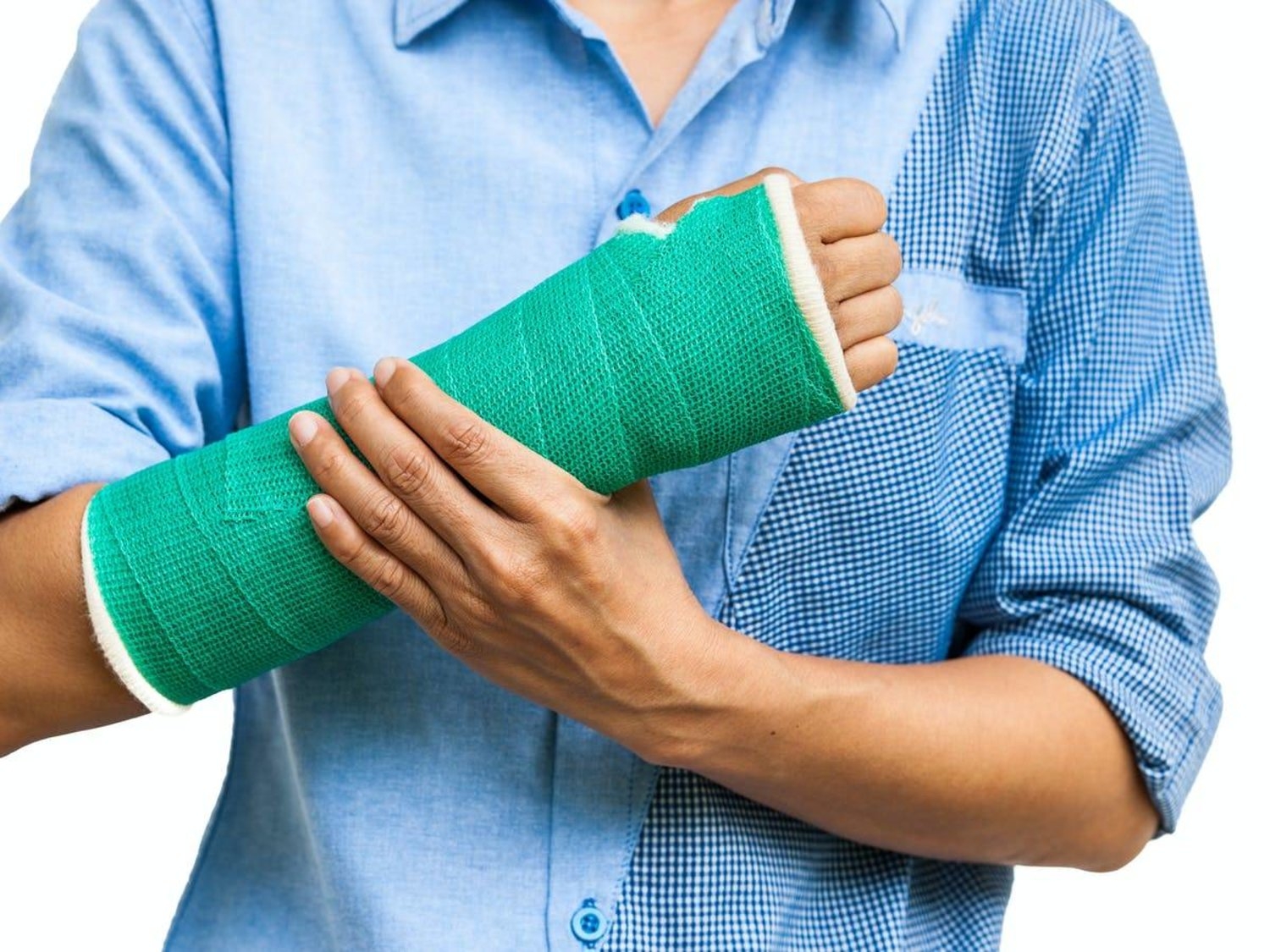 «الجبائر» تُعطي نفس نتائج جراحات كسور الذراع
