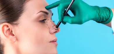 7 أنواع من عمليات رأب الأنف لغايات تجميلية أو علاجية