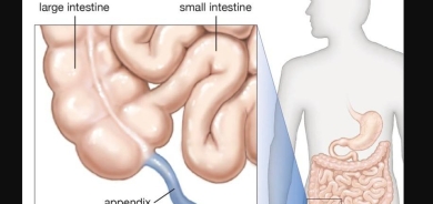 دراسة تكشف: الباركنسون قد يبدأ في الزائدة