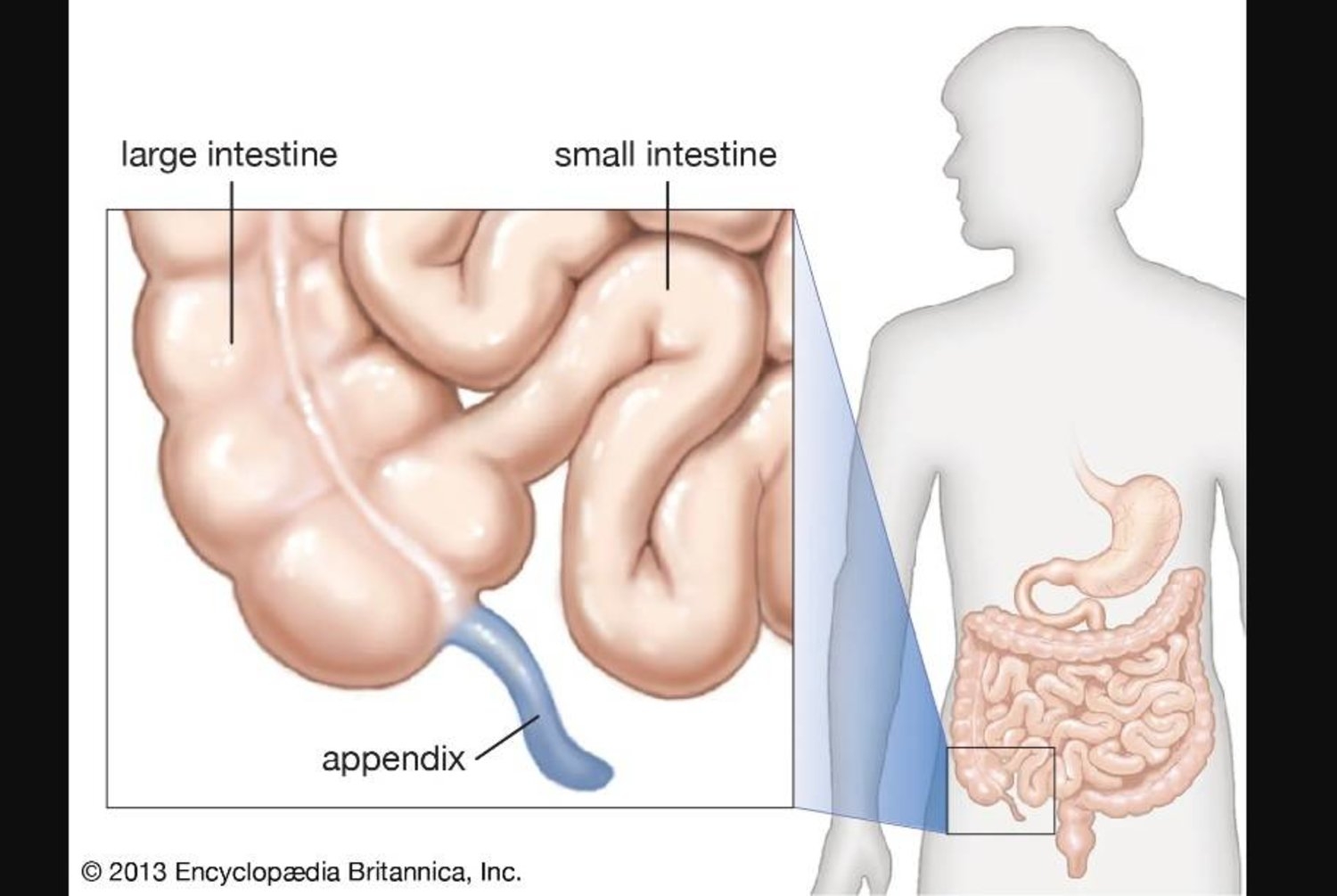 دراسة تكشف: الباركنسون قد يبدأ في الزائدة