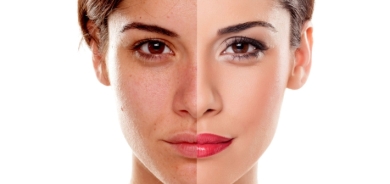 أسباب اسمرار البشرة .. ما هي طرق العلاج؟