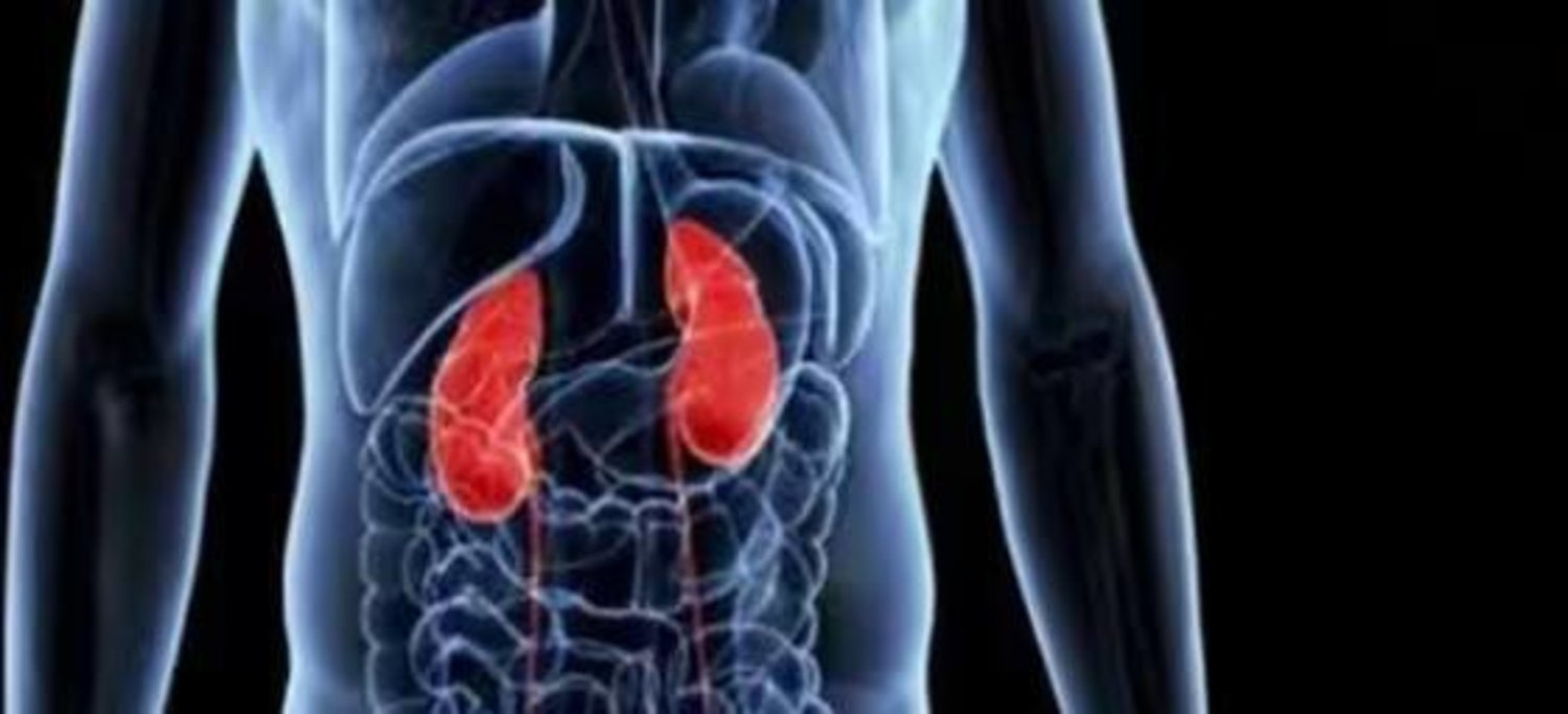 تعرّف على الأعراض الأولية لحصوات الكلى