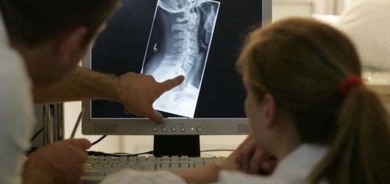 كيف تقي نفسك من هشاشة العظام؟