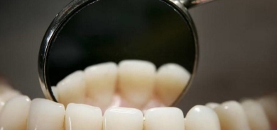 طريقة فعّالة وسهلة لتنظيف أسنانك