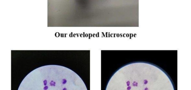 ثورة في تشخيص الملاريا باستخدام الذكاء الاصطناعي